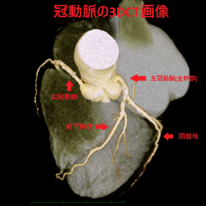 冠動脈とは|産業医科大学 医学部 心臓血管外科