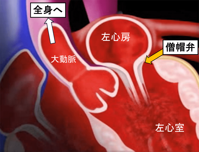 心臓の中の僧帽弁の場所|産業医科大学 医学部 心臓血管外科