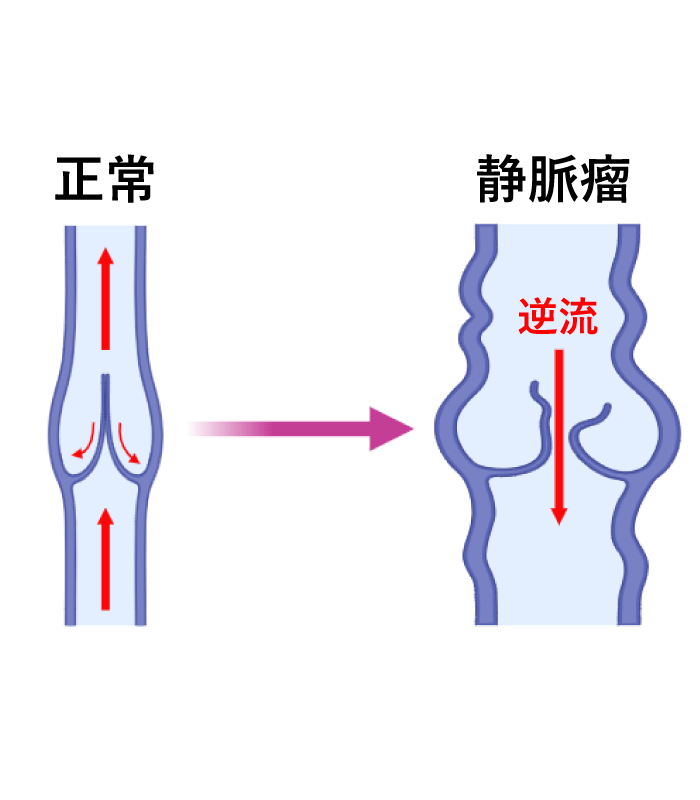 図6|末梢血管疾患|産業医科大学 医学部 心臓血管外科