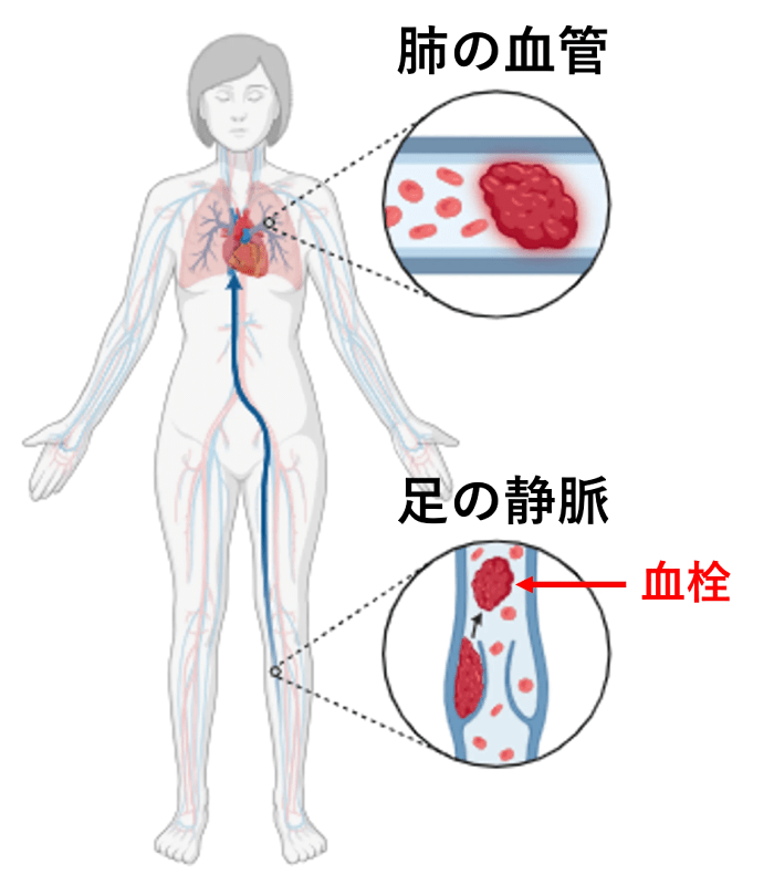 図8|末梢血管疾患|産業医科大学 医学部 心臓血管外科